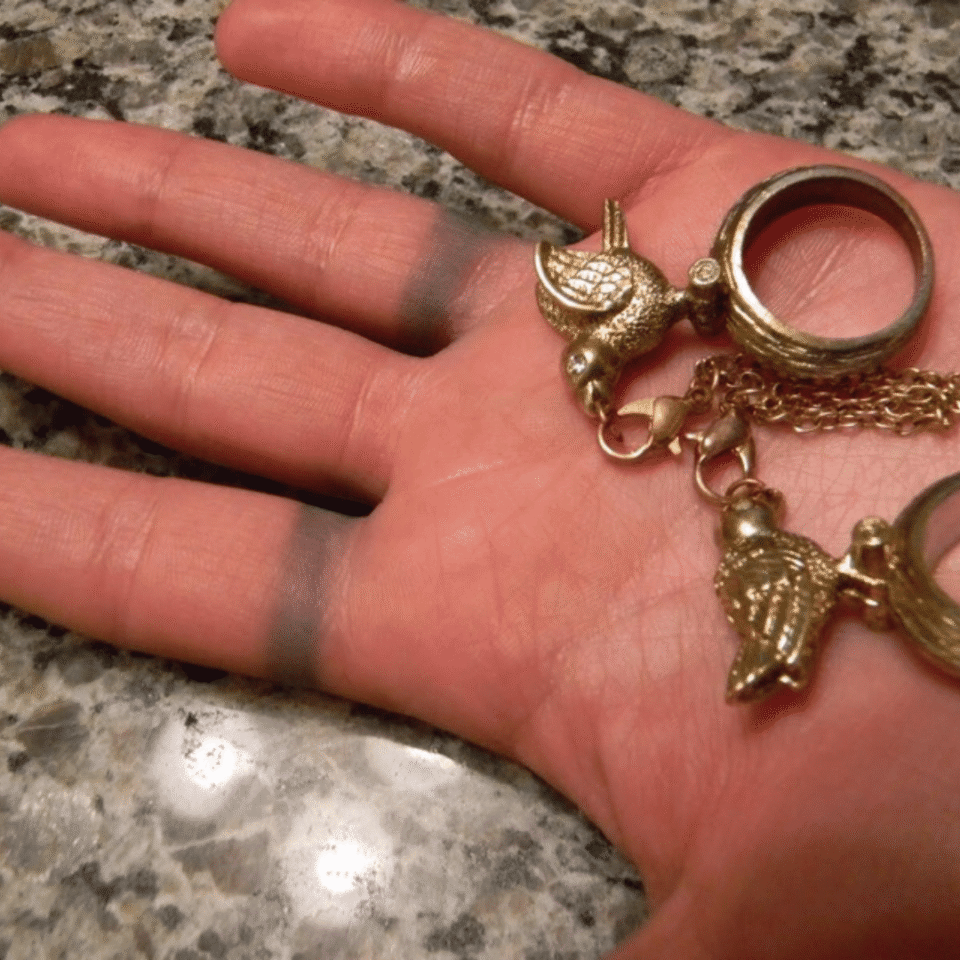 Photo of someone experiencing' green skin ' from wearing rings